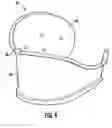Fig. 08 - Cuff assembly