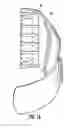 Fig. 13 - Cuff assembly
