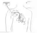 Fig. 01 - Implantable medical device with selectively configurable exposure operating mode programming options