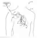 Fig. 01 - Implantable medical device with selectively configurable exposure operating mode programming options
