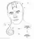Fig. 01 - ASSIGNMENT AND MANIPULATION OF IMPLANTABLE LEADS IN DIFFERENT ANATOMICAL REGIONS WITH IMAGE BACKGROUND