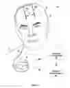 Fig. 02 - ASSIGNMENT AND MANIPULATION OF IMPLANTABLE LEADS IN DIFFERENT ANATOMICAL REGIONS WITH IMAGE BACKGROUND