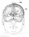 Fig. 01 - Neural interface system