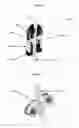 Fig. 19 - Inflatable minimally invasive system for delivering and securing an annular implant