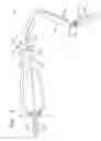 Fig. 05 - Sequential Heart Valve Leaflet Repair Device
