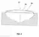 Fig. 05 - Method of manufacturing an implantable intraocular planar/convex, biconvex, planar/concave or convex/concave lens and a lens made using this method