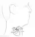 Fig. 01 - Voice Prothesis Automatic Flange Deployment Confirmation Method