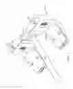 Fig. 22 - Knee balancing for revision procedures