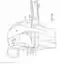 Fig. 37 - Knee balancing for revision procedures