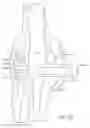 Fig. 40 - Knee balancing for revision procedures