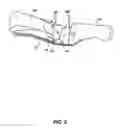 Fig. 06 - ARTIFICIAL JOINT PRESERVING TENDON AND/OR SESAMOID BONE STRUCTURE