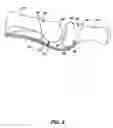 Fig. 09 - ARTIFICIAL JOINT PRESERVING TENDON AND/OR SESAMOID BONE STRUCTURE