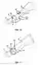 Fig. 10 - ARTIFICIAL JOINT PRESERVING TENDON AND/OR SESAMOID BONE STRUCTURE
