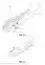 Fig. 11 - ARTIFICIAL JOINT PRESERVING TENDON AND/OR SESAMOID BONE STRUCTURE