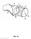 Fig. 13 - ARTIFICIAL JOINT PRESERVING TENDON AND/OR SESAMOID BONE STRUCTURE