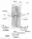 Fig. 02 - System of orienting femoral head for acetabular prosthesis alignment