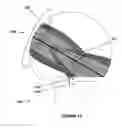 Fig. 11 - System of orienting femoral head for acetabular prosthesis alignment