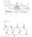 Fig. 15 - ELECTRONICALLY CONTROLLED PROSTHETIC SYSTEM