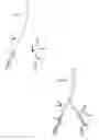 Fig. 03 - METHOD FOR MULTI-SCALE MESHING OF BRANCHING BIOLOGICAL STRUCTURES