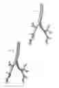 Fig. 04 - METHOD FOR MULTI-SCALE MESHING OF BRANCHING BIOLOGICAL STRUCTURES