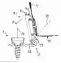 Fig. 01 - Fastening device