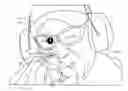 Fig. 01 - Vision enhancement apparatus to improve both near and far vision