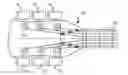 Fig. 01 - Tuning stabilizer for stringed instrument