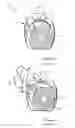 Fig. 02 - INHALER