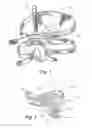 Fig. 02 - Forehead support for facial mask