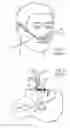 Fig. 02 - Methods, systems and devices for non-invasive ventilation including a non-sealing ventilation interface with a free space nozzle feature