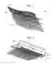 Fig. 02 - WEFT LESS HAIR EXTENSION AND METHOD FOR MAKING