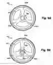 Fig. 09 - COMPRESSIBLE WHEEL TIP FOR A WALKING AID