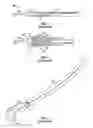 Fig. 03 - Apparatus and method for cleaning microsurgical instruments