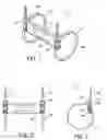 Fig. 02 - ELECTRONIC TAG HOUSING HAVING CABLE TIE SUPPORT