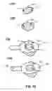 Fig. 09 - METHOD AND DEVICE FOR AN ACOUSTIC SENSOR SWITCH