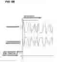 Fig. 11 - Image forming apparatus including intermediate transfer member velocity control feature