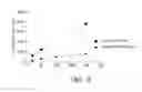 Fig. 07 - RADIOLABELING METHOD USING MULTIVALENT GLYCOLIGANDS AS HEPATIC RECEPTOR IMAGING AGENT