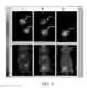 Fig. 08 - RADIOLABELING METHOD USING MULTIVALENT GLYCOLIGANDS AS HEPATIC RECEPTOR IMAGING AGENT