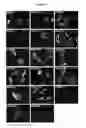 Fig. 07 - COMPOSITIONS AND METHODS FOR TREATING CANCER AND MODULATING STRESS GRANULE FORMATION