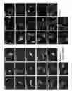 Fig. 08 - COMPOSITIONS AND METHODS FOR TREATING CANCER AND MODULATING STRESS GRANULE FORMATION