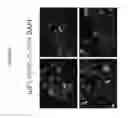 Fig. 22 - COMPOSITIONS AND METHODS FOR TREATING CANCER AND MODULATING STRESS GRANULE FORMATION