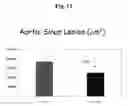 Fig. 09 - Methods employing and compositions containing defined oxidized phospholipids for prevention and treatment of atherosclerosis