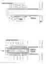 Fig. 01 - Methods and devices for correcting spinal deformity with pharmaceutical-eluting pedicle screws