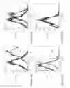 Fig. 04 - Renal tissue regeneration