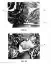 Fig. 07 - Conformable tissue repair implant capable of injection delivery