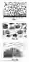 Fig. 02 - Delivery System for Drug and Cell Therapy