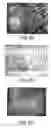 Fig. 04 - Delivery System for Drug and Cell Therapy