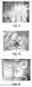 Fig. 08 - Delivery System for Drug and Cell Therapy