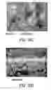 Fig. 13 - Delivery System for Drug and Cell Therapy
