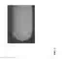 Fig. 02 - Break resistant gel capsule